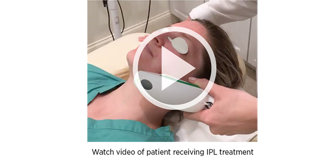 Watch video of patient receiving IPL treatment.