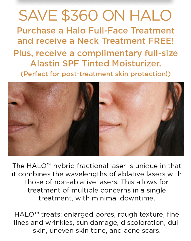 SAVE 360.00 ON HALO. Purchase a Halo Full-Face Treatment and receive a Neck Treatment FREE. Plus, receive a complimentary full-size Alastin SPF Tinted Moisturizer. The HALO hybrid fractional laser is unique in that it combines the wavelengths of ablative lasers with those of non-ablative lasers. This allows for treatment of multiple concerns in a single treatment, with minimal downtime. HALO treats: enlarged pores, rough texture, fine lines and wrinkles, sun damage, discoloration, dull skin, uneven skin tone, and acne scars.